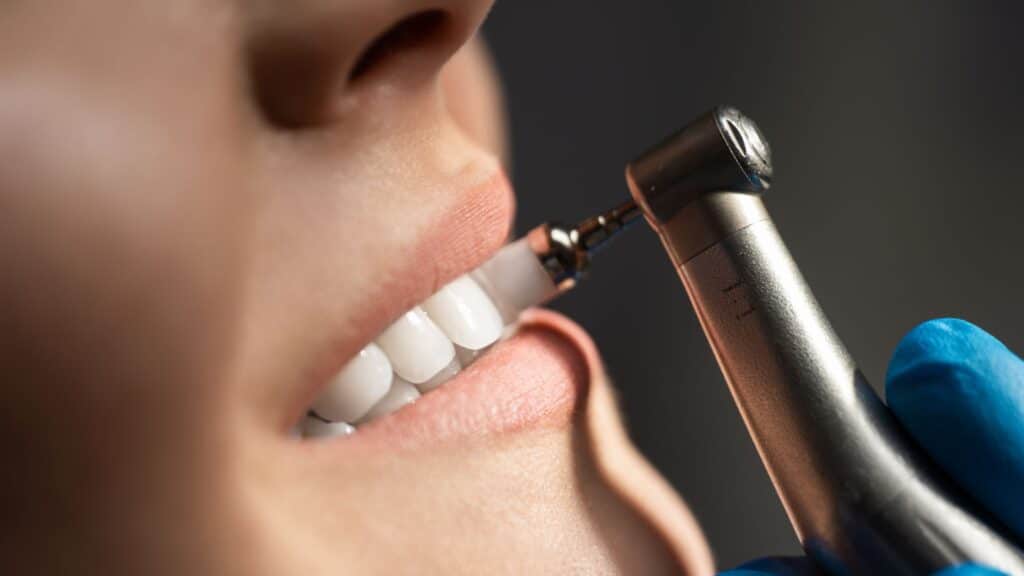 Know The Importance Of Professional Dental Cleaning