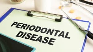 Clipboard displaying "PERIODONTAL DISEASE" text in clinical dental office setting with instruments.