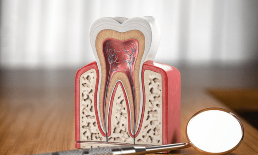 Root Canal Therapy