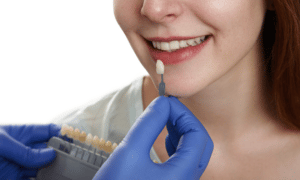 How Should You Care For Your Dental Veneers Once They Are In Place