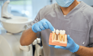 Dental Crowns in Blackwell Dentistry