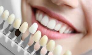 Cosmetic Dentistry in Blackwell OK
