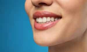 Cosmetic Dentist in Blackwell