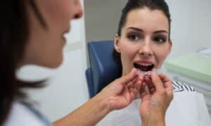 Invisalign Blackwell