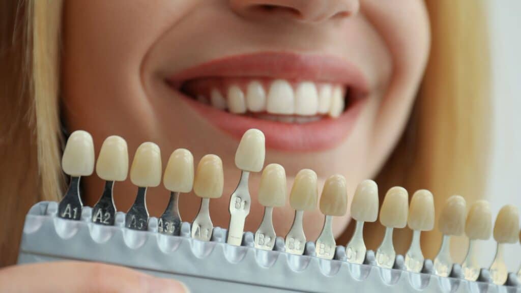 Cosmetic Dentistry in Blackwell