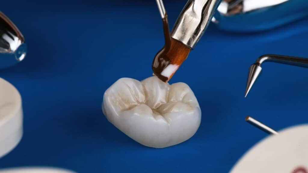 Dental Crowns Blackwell Dentistry