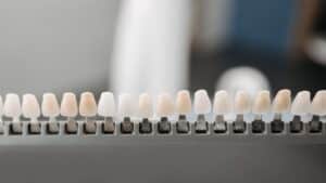 How to Care for Your Porcelain Veneers