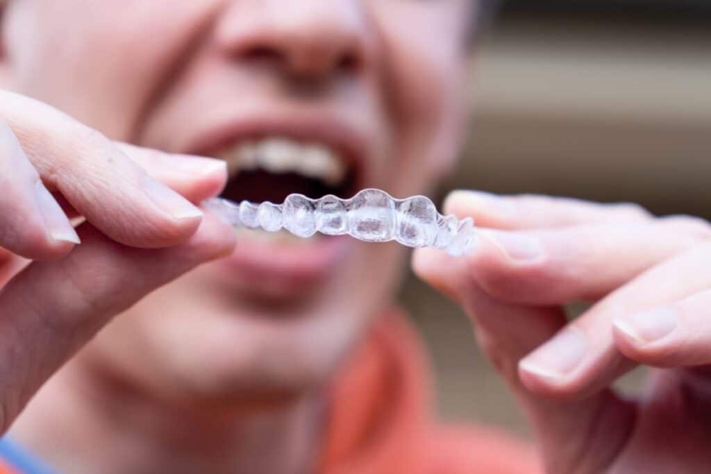 invisalign in Blackwell
