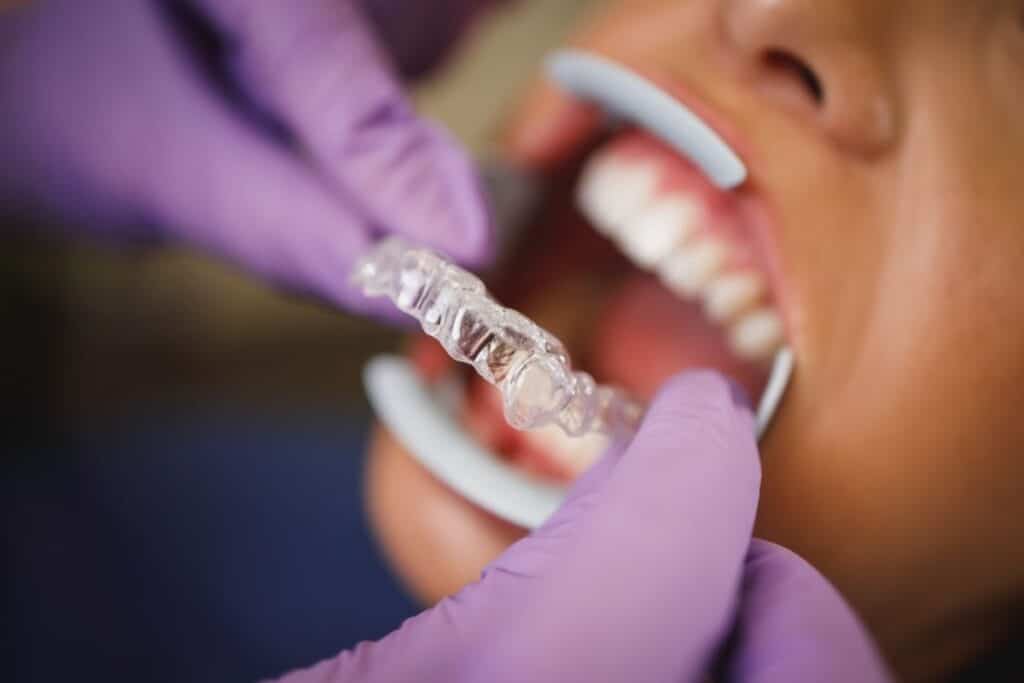 invisalign in Blackwell