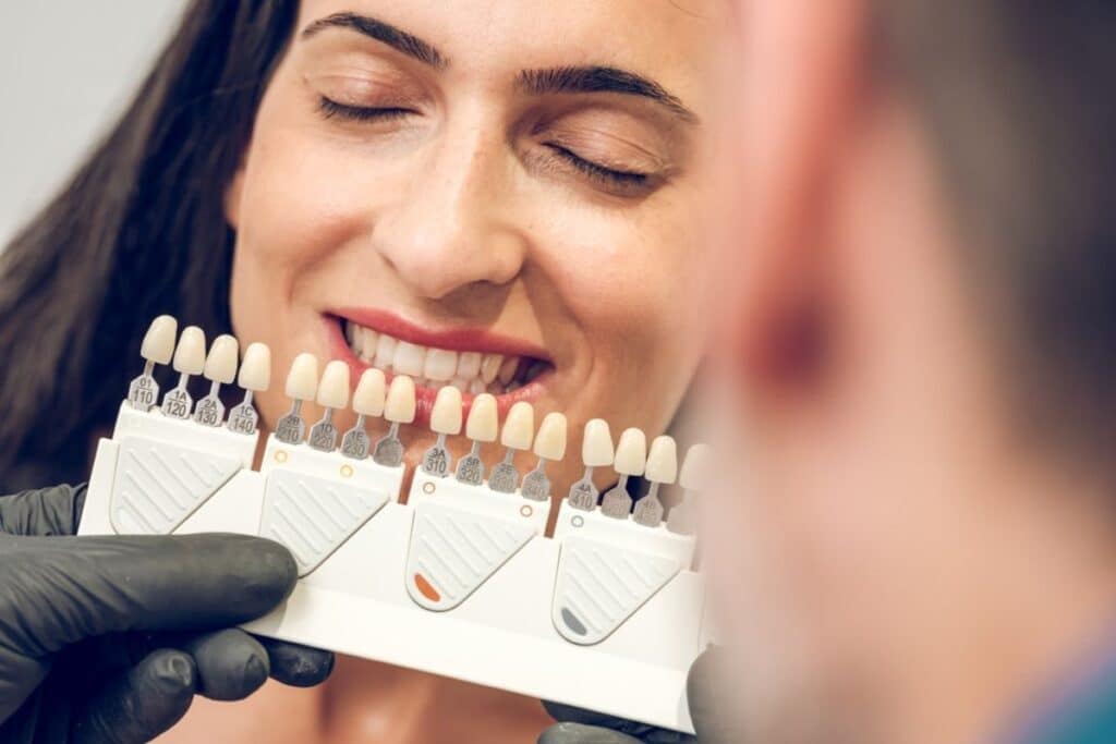 porcelain veneers in Blackwell