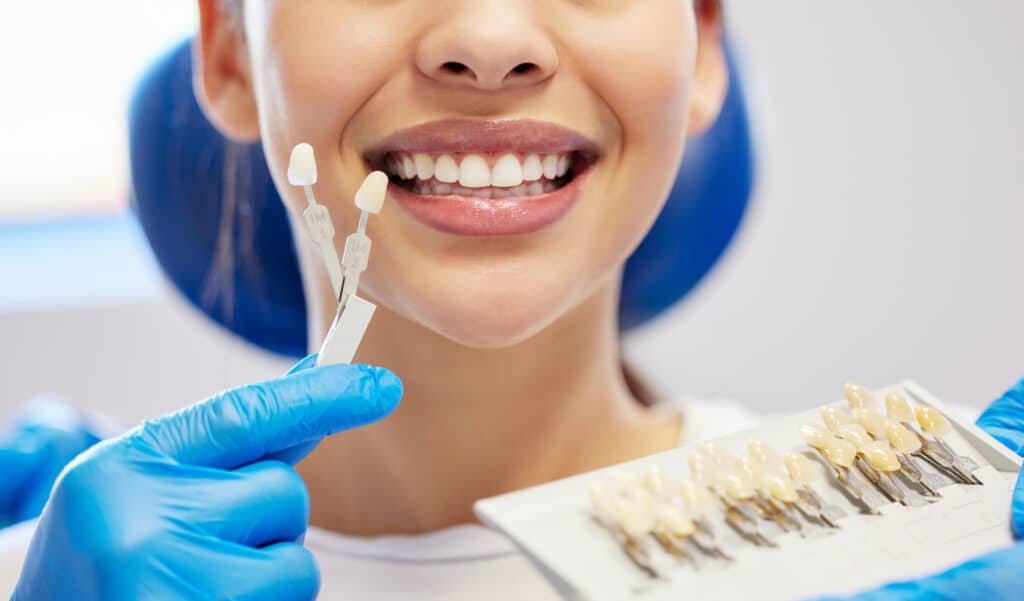 Alternatives to Dental Veneers: Better Treatment Options for Your Smile