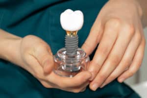 Factors That Determine Dental Implant Success