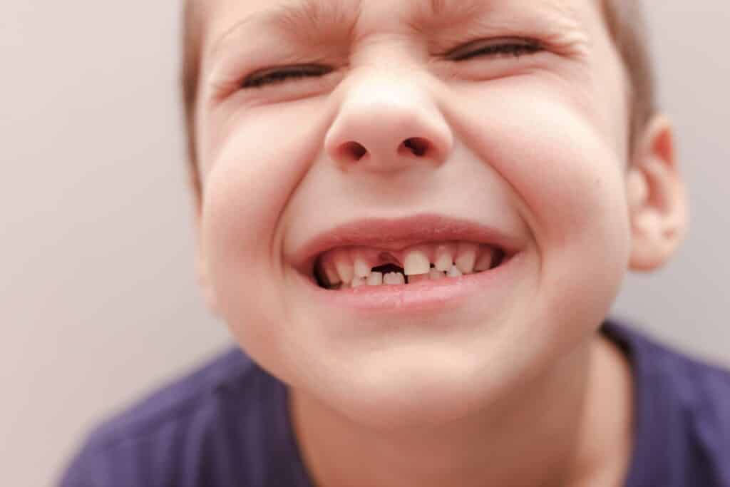 Child knocked out tooth
