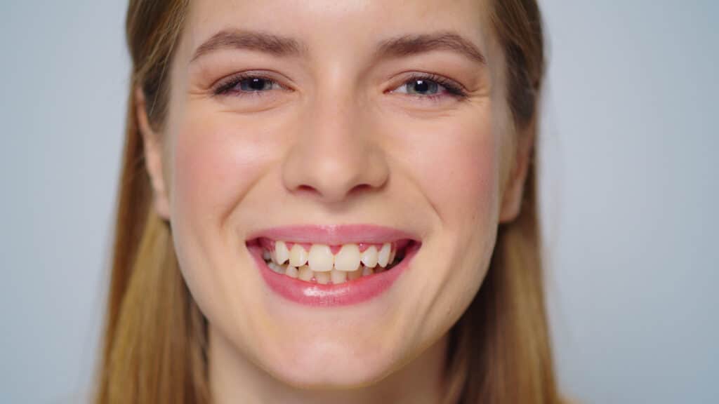 ClinCheck: Visualize Your Invisalign Journey Before Starting