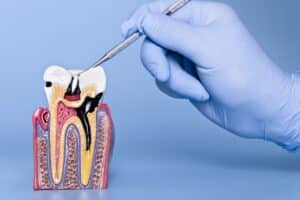 Regular Visits to a Kids’ Dentist Prevent Long-Term Oral Problems