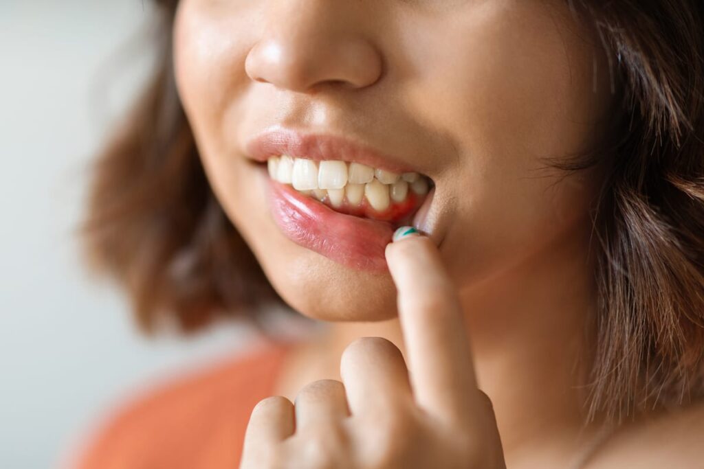 Periodontal Care in Blackwell